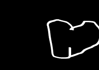 MTV：爱你在心口难开（Anonymous） 截图 2/8