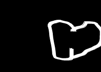 MTV：爱你在心口难开（Anonymous） 截图 3/8
